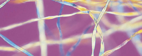 Is Polyester Warmer Than Cotton